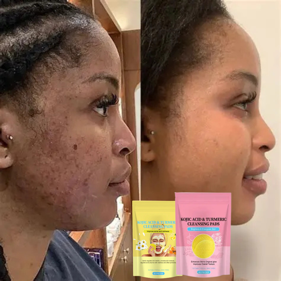 LUMINA PAD™ – Pele limpa, clara e radiante em 1 minuto. Sem cremes. Sem químicos.